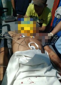 Terlibat Perkelahian, Warga Anduonohu Tewas Usai Ditikam