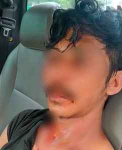 Kepergok Curi BBM Jenis Solar, Seorang Pria di Kendari Babak Belur Diamuk Warga