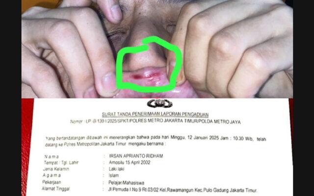 Diduga Aniaya Mahasiswa, KAHMI Sultra Desak Mendagri Copot Ridwan Badallah dari Jabatan Pj Bupati Buton Selatan